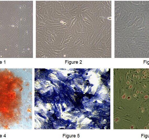 Primary Rat Bone Marrow-derived Mesenchymal Stem Cells (BMMSCs)