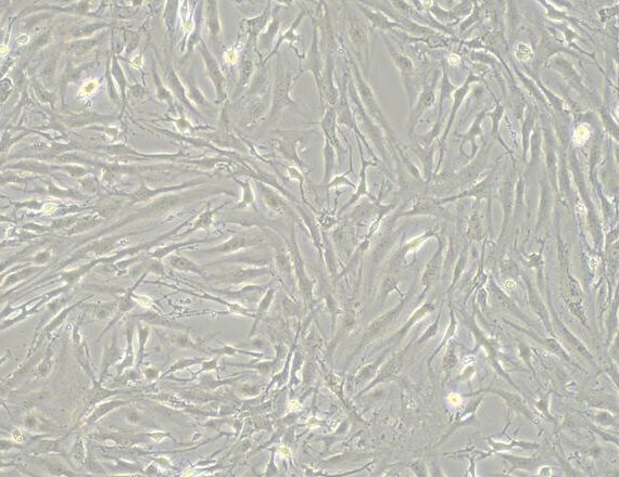 Primary Human Adult Dermal Fibroblasts (ADF)