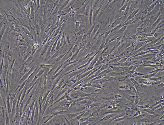 Primary Mouse Neonatal Dermal Fibroblasts (NDF)
