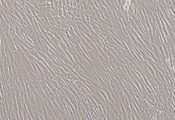 Primary Human Periodontal Ligament Fibroblasts (PDLF)