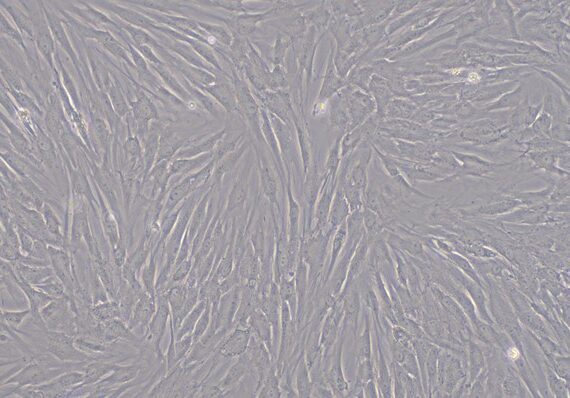 Primary Mouse Periodontal Ligament Fibroblasts (PDLF)