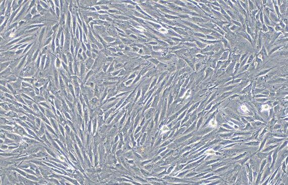 Primary Rat Periodontal Ligament Fibroblasts (PDLF)
