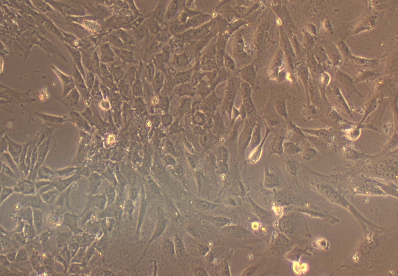 Primary Rat Adrenal Fibroblasts (ADF)