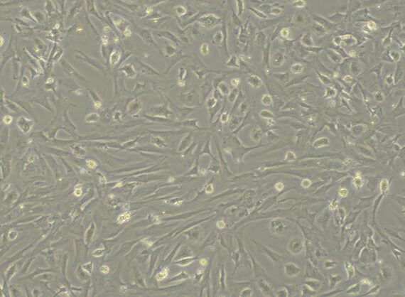 Primary Mouse Splenic Fibroblasts (SF)