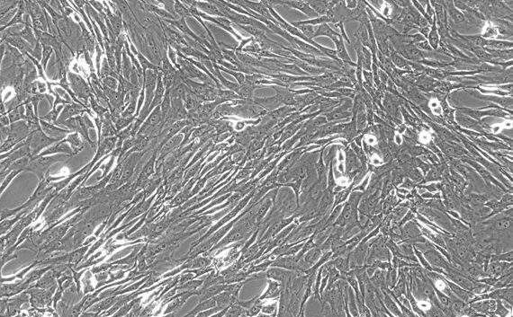 Primary Rat Splenic Fibroblasts (SF)