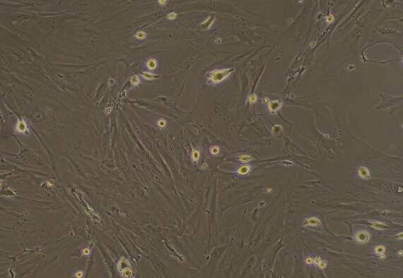 Primary Mouse Cardiac Fibroblasts (CF)