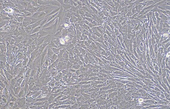 Primary Rat Cardiac Fibroblasts (CF)