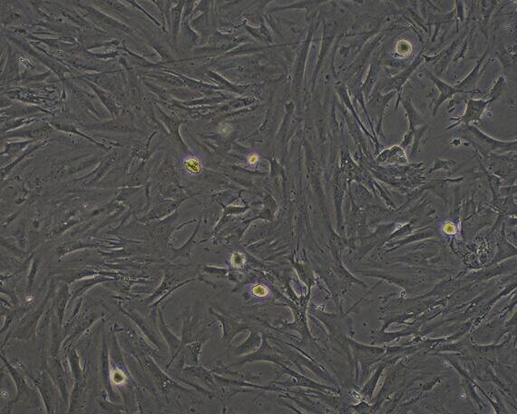 Primary Rabbit Cardiac Fibroblasts (CF)