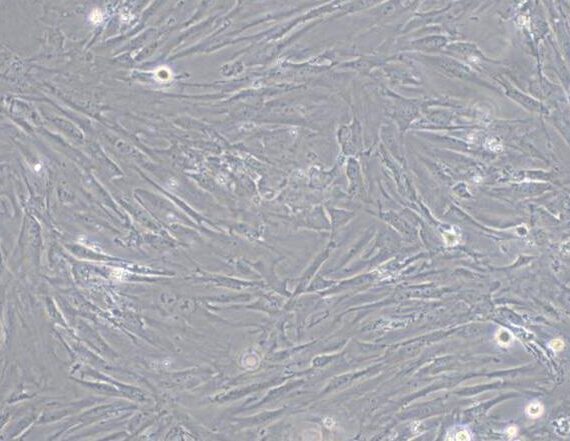 Primary Mouse Mammary Fibroblasts (MF)