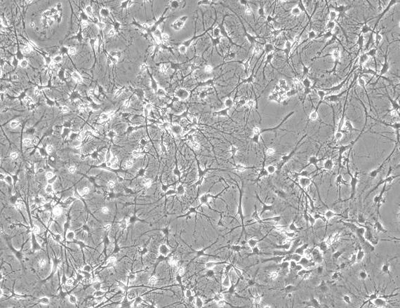 Primary Rat Hippocampal Neuron Cells (HNC)