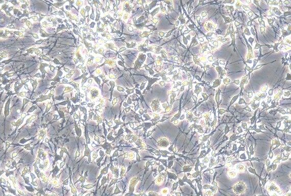 Primary Mouse Brain Stem Neuron Cells (BSNC)