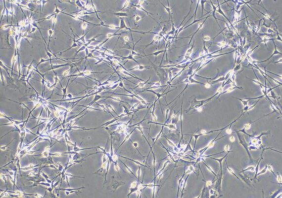 Primary Rat Brain Stem Neuron Cells (BSNC)