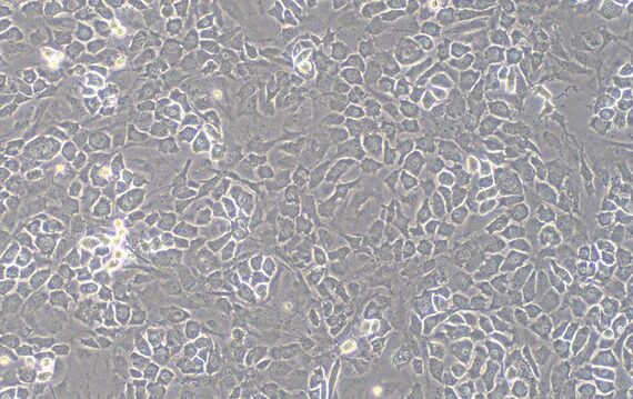 Primary Mouse Osteoblasts (OB)