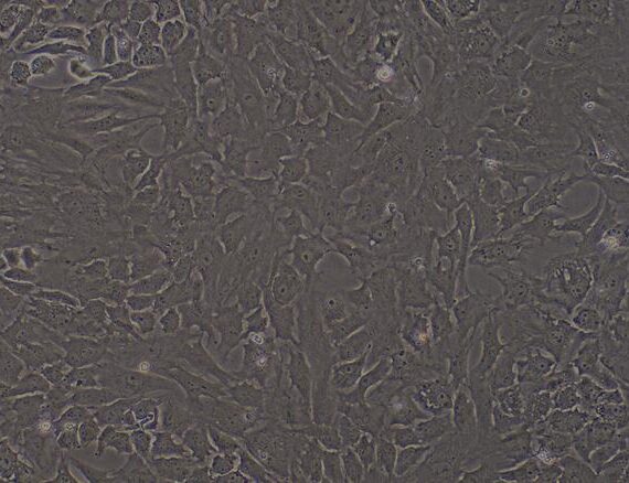 Primary Rat Osteoblasts (OB)