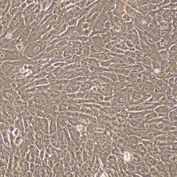 Primary Rabbit Osteoblasts (OB)