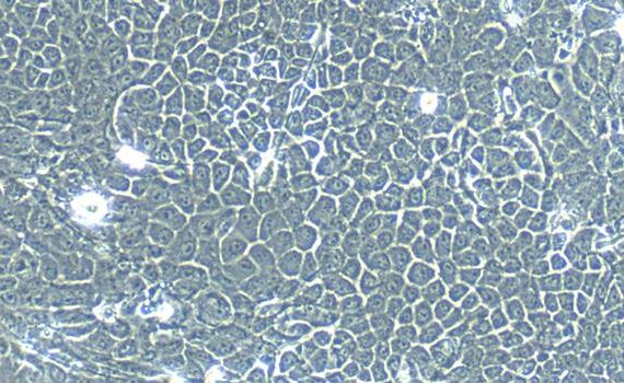Primary Mouse Esophageal Epithelial Cells (EEC)