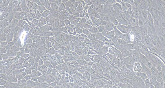 Primary Rat Esophageal Epithelial Cells (EEC)