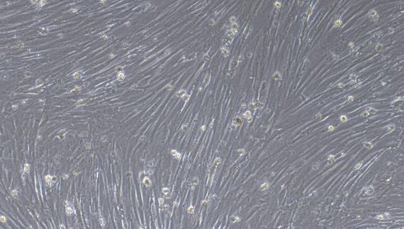 Primary Canine Esophageal Smooth Muscle Cells (ESMC)