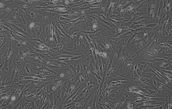 Primary Mouse Esophageal Smooth Muscle Cells (ESMC)