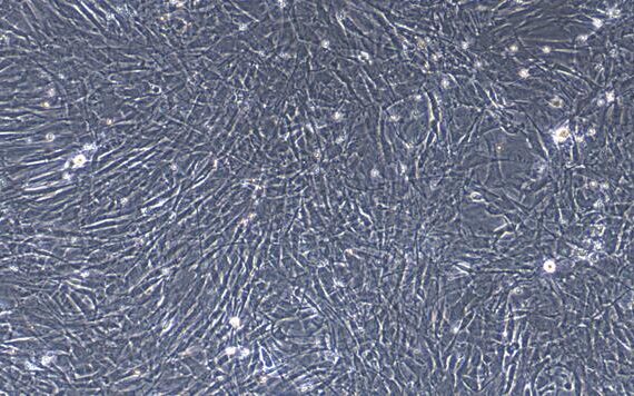 Primary Rabbit Esophageal Smooth Muscle Cells (ESMC)
