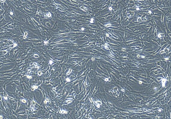 Primary Mouse Gastric Smooth Muscle Cells (GSMC)