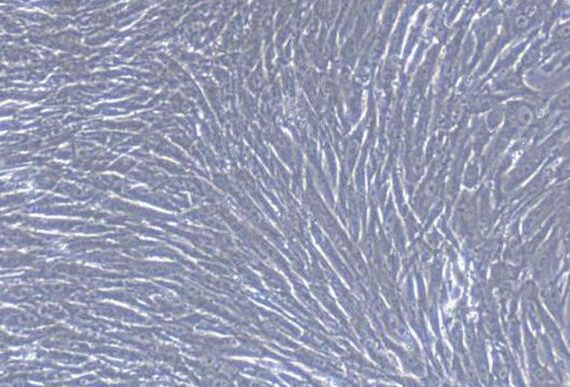 Primary Rabbit Gastric Smooth Muscle Cells (GSMC)
