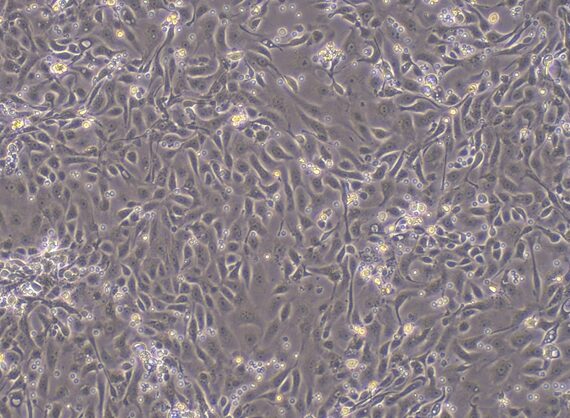 Primary Mouse Cervical Epithelial Cells (CrEC)
