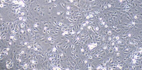 Primary Rat Cervical Epithelial Cells (CrEC)