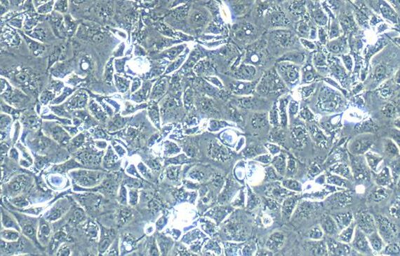 Primary Rabbit Cervical Epithelial Cells (CrEC)