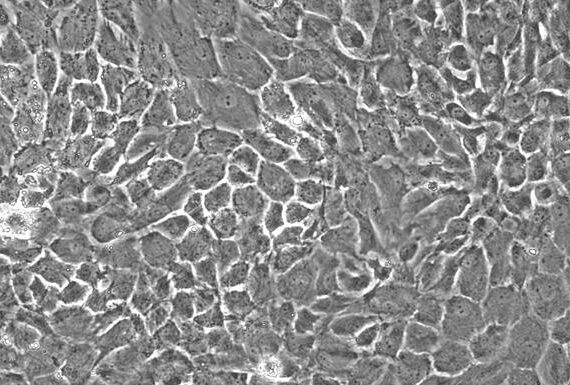 Primary Rabbit Nucleus Pulposus Cells (NPC)