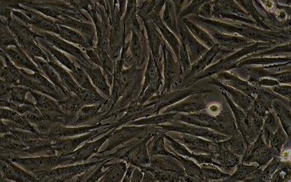 Primary Rabbit Synovial Cells (SYC)