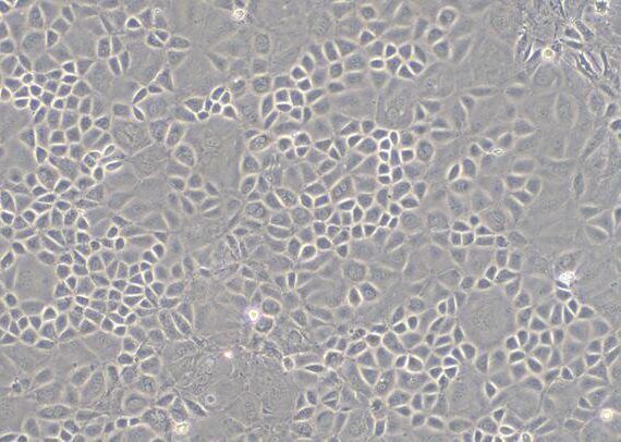 Primary Mouse Thymic Epithelial Cells (TEC)