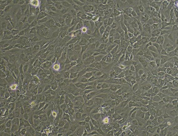 Primary Mouse Adipose Microvascular Endothelial Cells (AMEC)