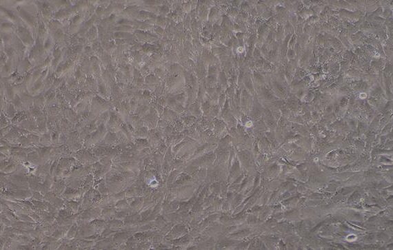Primary Rabbit Coronary Artery Endothelial Cells (CAEC)