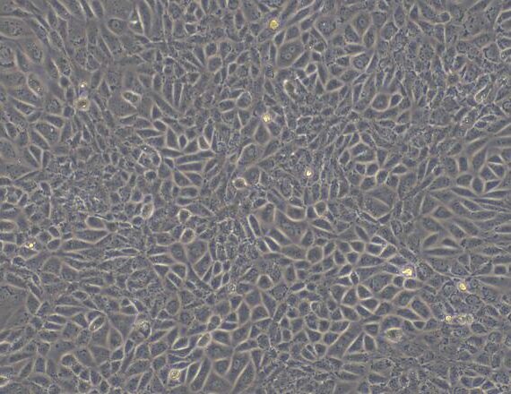 Primary Rat Hepatic Sinusoidal Endothelial Cells (HSEC)