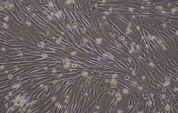 Primary Canine Ovarian Fibroblasts (OF)