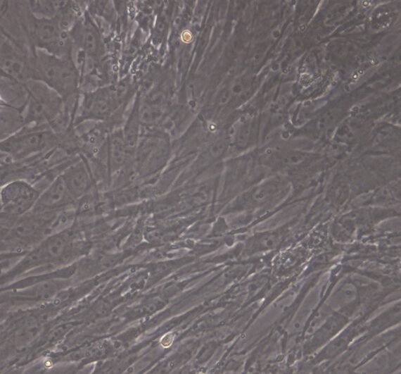Primary Mouse Ovarian Fibroblasts (OF)