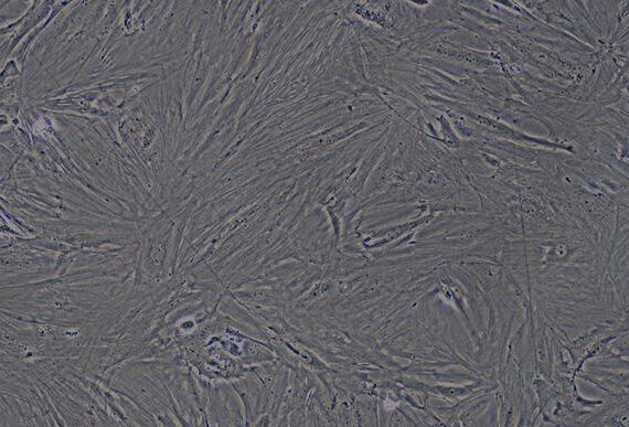 Primary Rat Ovarian Fibroblasts (OF)