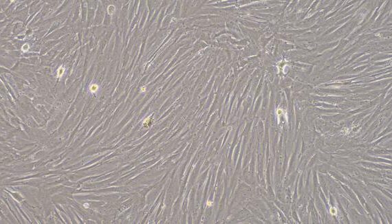 Primary Rabbit Pulmonary Artery Smooth Muscle Cells (PASMC)