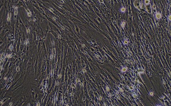 Primary Mouse Prostate Fibroblasts (PF)