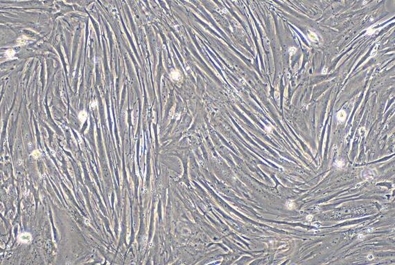 Primary Rabbit Prostate Fibroblasts (PF)