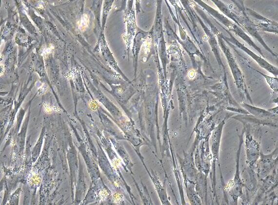 Primary Rat Pancreatic Stellate Cells (PSC)