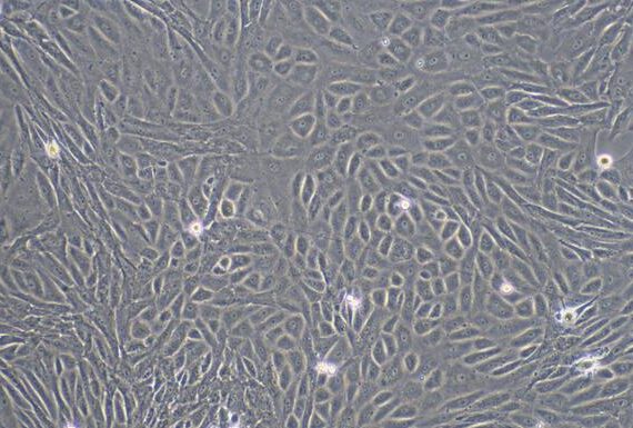 Primary Rabbit Retinal Pigment Epithelial Cells (RPEC)