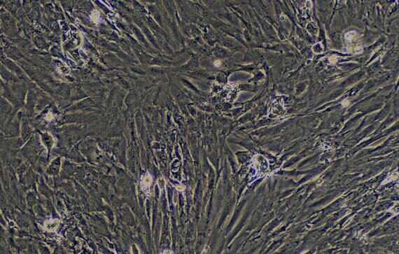 Primary Rat Gingival Fibroblasts (GF)