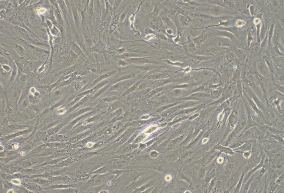 Primary Rabbit Pericardial Fibroblasts (PF)