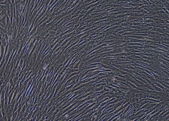 Primary Caprine Aortic Smooth Muscle Cells (ASMC)