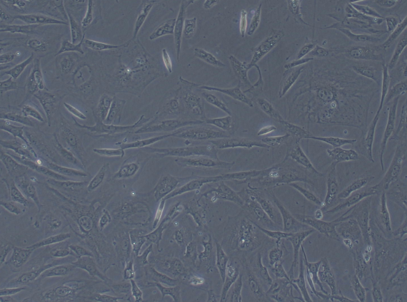 Primary Mouse Aortic Smooth Muscle Cells (ASMC)