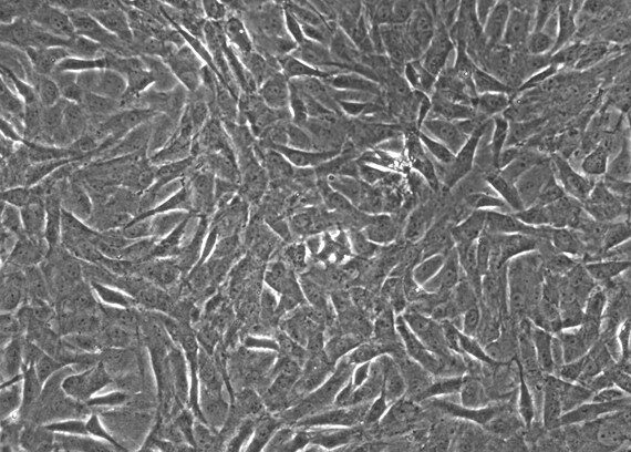 Primary Rat Aortic Smooth Muscle Cells (ASMC)