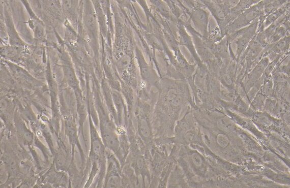 Primary Rabbit Aortic Smooth Muscle Cells (ASMC)