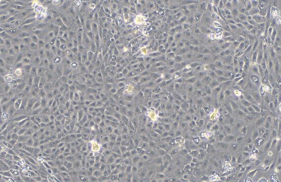 Primary Mouse Seminal Vesicle Epithelial Cells (SVEC)